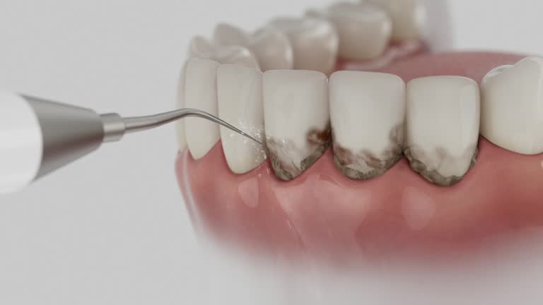 Trusted Emergency Dentist service in Collins, MS - Dentist Open Now